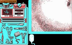 Screen - Life and Death