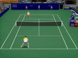 Tennis Elbow:  